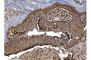 IHC analysis of NSF using anti-NSF antibody (ABIN7601630). (NSF 抗体  (AA 4-636))