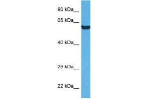 Host:  Rabbit  Target Name:  P4HB  Sample Tissue:  Human HepG2 Whole Cell  Antibody Dilution:  1ug/ml (P4HB 抗体  (N-Term))