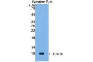 Detection of Recombinant S100B, Mouse using Polyclonal Antibody to S100 Calcium Binding Protein B (S100B) (S100B 抗体  (AA 1-92))