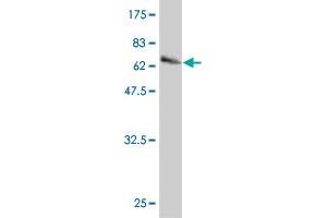 Western Blot detection against Immunogen (67. (Hepsin 抗体  (AA 40-417))