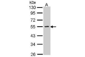 WB Image Sample (30 ug of whole cell lysate) A: Molt-4 , 10% SDS PAGE antibody diluted at 1:500 (SPHK1 抗体  (C-Term))