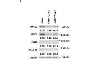 SMYD3 knockdown downregulates HR gene expressions. (MDC1 抗体)