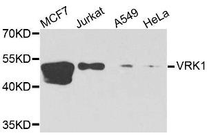 Western blot analysis of extracts of various cell lines, using VRK1 antibody. (VRK1 抗体  (AA 257-396))