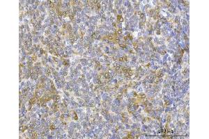 IHC analysis of RRS1 using anti-RRS1 antibody (ABIN7602918). (RRS1 抗体  (C-Term))