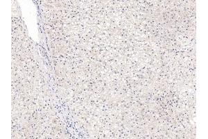 Detection of GPC3 in Human Liver Tissue using Polyclonal Antibody to Glypican 3 (GPC3) (Glypican 3 抗体  (AA 343-559))
