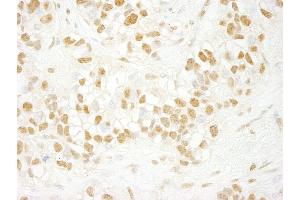 Immunohistochemistry (IHC) image for anti-CDC5 Cell Division Cycle 5-Like (S. Pombe) (CDC5L) (AA 752-802) antibody (ABIN7448468)