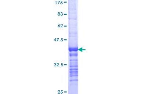 LIG1 Protein (AA 810-919) (GST tag)