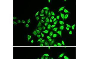 Immunofluorescence analysis of U2OS cells using NAPG Polyclonal Antibody (NAPG 抗体)