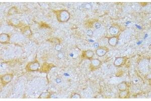Immunohistochemistry of paraffin-embedded Rat brain using ACADSB Polyclonal Antibody at dilution of 1:100 (40x lens). (ACADSB 抗体)