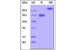 Human VEGF R3, Fc Tag on  under reducing (R) and ing (NR) conditions.