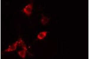 ABIN6275502 staining  HepG2 cells by IF/ICC. (RHOB 抗体  (Internal Region))