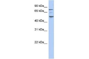 WB Suggested Anti-CSNK1E Antibody Titration: 0. (CK1 epsilon 抗体  (N-Term))