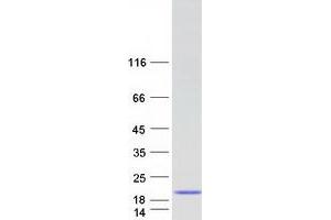 Western Blotting (WB) image for Myosin Light Chain 6, Alkali, Smooth Muscle and Non Muscle (MYL6) (Transcript Variant 2) protein (Myc-DYKDDDDK Tag) (ABIN2726673)
