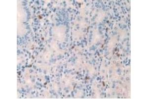 Detection of 0 in Human Stomach Tissue using Monoclonal Antibody to Amylin (Amylin/DAP 抗体)