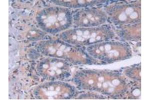 IHC-P analysis of Rat Intestine Tissue, with DAB staining. (IL12A 抗体  (AA 23-215))