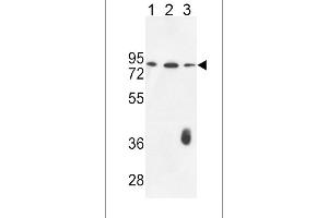 F12 Antibody (N-term) (ABIN653621 and ABIN2842977) western blot analysis in K562(lane 1),CEM(lane 2),MDA-M(lane 3) cell line lysates (35 μg/lane). (F12 抗体  (N-Term))