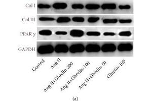 The effect of different concentrations of Ghrelin on collagen I, collagen III, and PPAR-γ protein expression in Ang II-infused rats. (GAPDH 抗体  (AA 1-335))