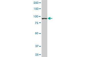 AMPD2 monoclonal antibody (M01), clone 2F5. (AMPD2 抗体  (AA 86-185))