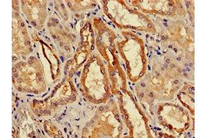 Immunohistochemistry (IHC) image for anti-Aminocarboxymuconate Semialdehyde Decarboxylase (ACMSD) (AA 33-129) antibody (ABIN7142142)