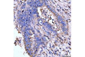 IHC analysis of Giantin/GOLGB1 using anti-Giantin/GOLGB1 antibody (ABIN7600139).