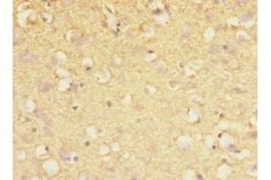 Immunohistochemistry of paraffin-embedded human brain tissue using ABIN7169067 at dilution of 1:100 (MARK1 抗体  (AA 560-700))