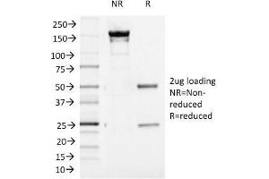 SDS-PAGE Analysis Purified Aurora B Mouse Monoclonal Antibody (AURKB/1521). (Aurora Kinase B 抗体  (AA 89-251))