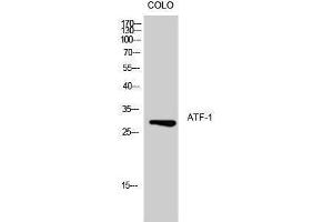Western Blotting (WB) image for anti-Activating Transcription Factor 1 (AFT1) (Ser157) antibody (ABIN3173928) (AFT1 抗体  (Ser157))