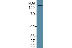 Western Blot; Sample: Human Lung lysate; Primary Ab: 1µg/ml Rabbit Anti-Human FAK Antibody Second Ab: 0. (FAK 抗体  (AA 798-1041))