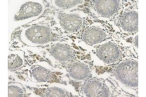 ABIN6257993 and ABIN6273660 at 1/100 staining human normal kidney tissue by IHC-P.
