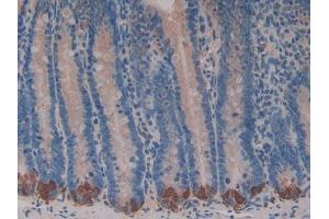 DAB staining on IHC-P; Samples: Rat Intestine Tissue (BRCA2 抗体  (AA 2913-3151))