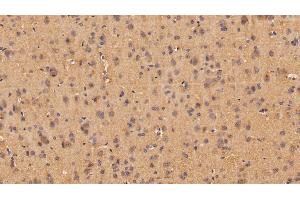 Detection of ANG in Rat Cerebrum Tissue using Polyclonal Antibody to Angiogenin (ANG)