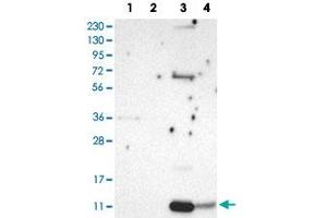 Western Blot analysis of Lane 1: RT-4 cell, Lane 2: U-251 MG sp cell, Lane 3: human plasma tissue (IgG/HSA depleted) and Lane 4: human liver tissue lysates with PPBP polyclonal antibody .