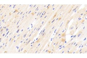 Detection of TIMP4 in Human Cardiac Muscle Tissue using Polyclonal Antibody to Tissue Inhibitors Of Metalloproteinase 4 (TIMP4) (TIMP4 抗体  (AA 32-224))
