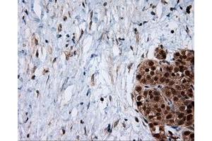 Immunohistochemical staining of paraffin-embedded Kidney tissue using anti-SRR mouse monoclonal antibody. (SRR 抗体)