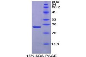 SDS-PAGE analysis of Chicken Gremlin 1 Protein. (GREM1 蛋白)