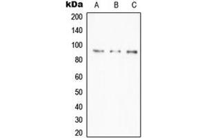 Western blot analysis of A20 expression in HeLa (A), Daudi (B), RAW264. (IGKV1-27 抗体  (Center))