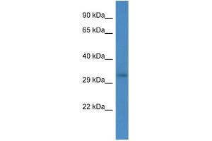 Host:  Rabbit  Target Name:  RRM2B  Sample Type:  293T Whole cell lysates  Antibody Dilution:  1. (RRM2B 抗体  (Middle Region))