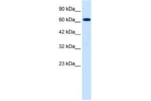 Western Blotting (WB) image for anti-Sodium Channel, Nonvoltage-Gated 1, beta (SCNN1B) antibody (ABIN633767)
