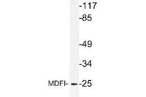 Western blot (WB) analysis of MDFI antibody in extracts from Jurkat cells. (MDFI 抗体)