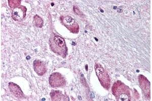 Anti-GABRA3 antibody  ABIN1048639 IHC staining of human brain, basal nucleus of Meynert. (GABRA3 抗体  (N-Term))