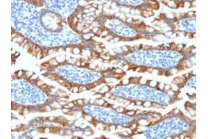 Formalin-fixed, paraffin-embedded human Small Intestine stained with Cytokeratin 8 Rabbit Recombinant Monoclonal Antibody (KRT8/2174R). (Recombinant KRT8 抗体)