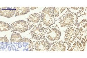 Immunohistochemistry of paraffin-embedded Mouse testis tissue using Smad4 Polyclonal Antibody at dilution of 1:200. (SMAD4 抗体)