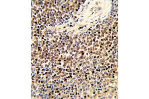 Formalin-fixed and paraffin-embedded human spleen tissue reacted with CYP24A1 Antibody , which was peroxidase-conjugated to the secondary antibody, followed by DAB staining.