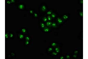 Immunofluorescence staining of Hela cells with ABIN7176203 at 1:100, counter-stained with DAPI.