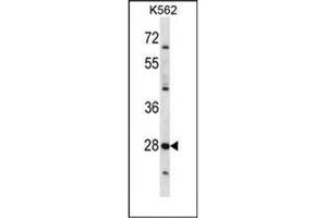 Western blot analysis of PRSS27 Antibody (C-term) . (PRSS27 抗体  (C-Term))