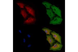 ABIN6261445 and ABIN6278454 staining  cells by IF/ICC. (EEF1B2 抗体  (Internal Region))