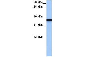 GSG1 antibody used at 1 ug/ml to detect target protein. (GSG1 抗体  (C-Term))