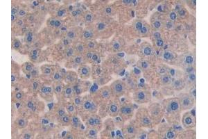 Detection of IL11Ra in Mouse Liver Tissue using Polyclonal Antibody to Interleukin 11 Receptor Alpha (IL11Ra)