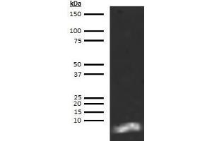 Western Blotting (WB) image for anti-Brain Natriuretic Peptide 45 (BNP-45) antibody (Biotin) (ABIN613019) (BNP-45 抗体  (Biotin))