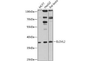 Western blot analysis of extracts of various cell lines, using ELOVL2 antibody (ABIN7266927) at 1:1000 dilution. (ELOVL2 抗体  (AA 247-296))
